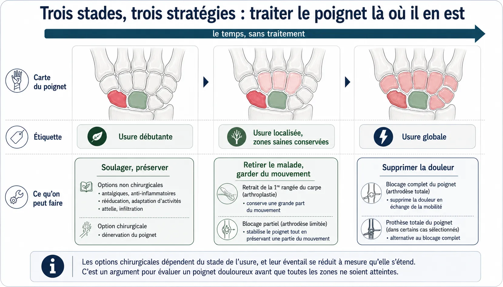Arthrose du poignet — illustration médicale