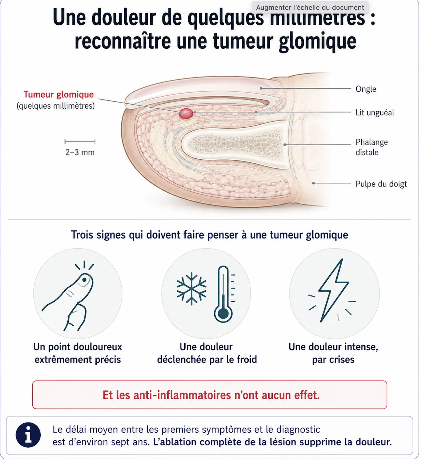 Boules et kystes des doigts — illustration médicale