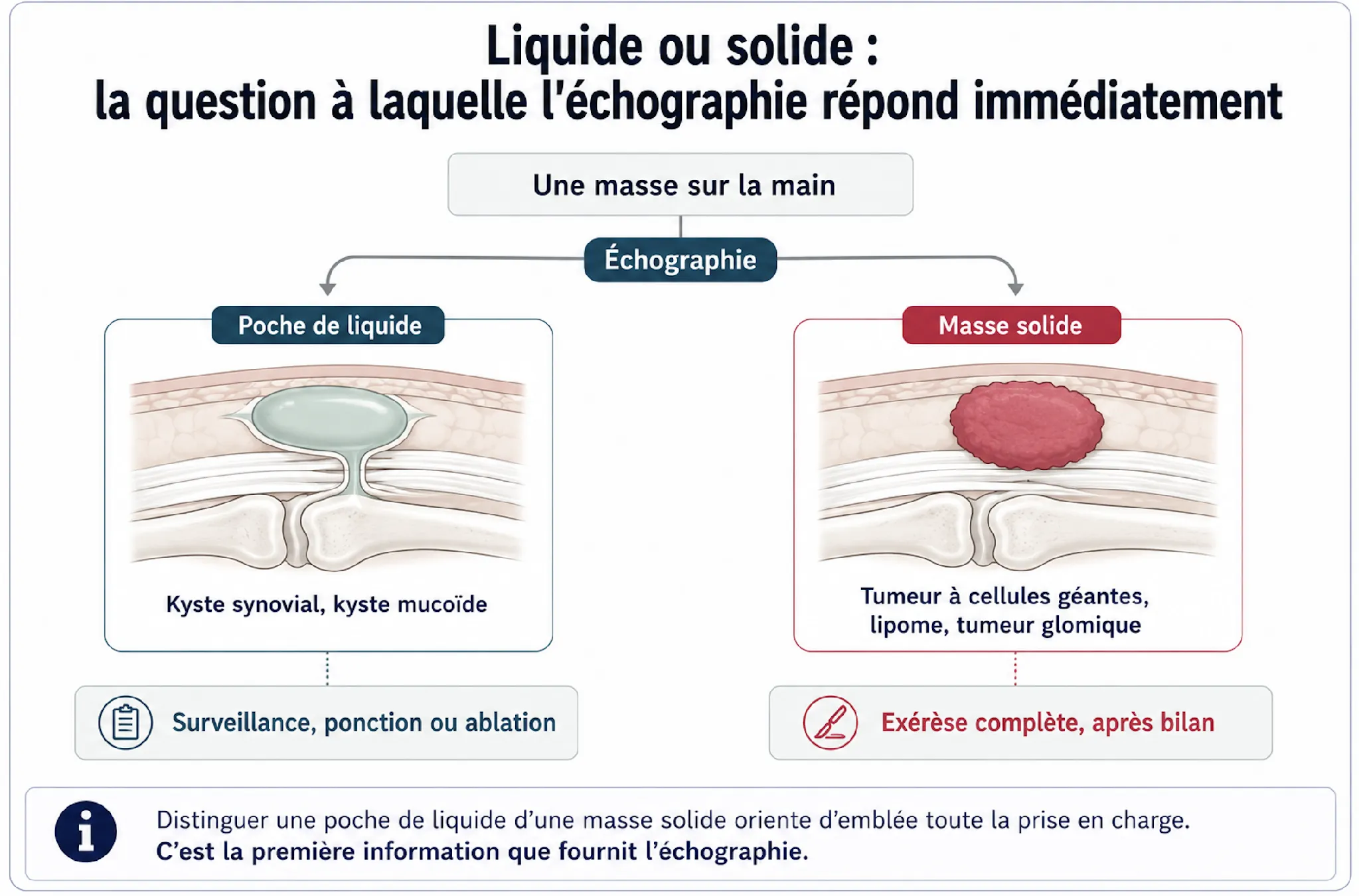 Boules et kystes des doigts — illustration médicale