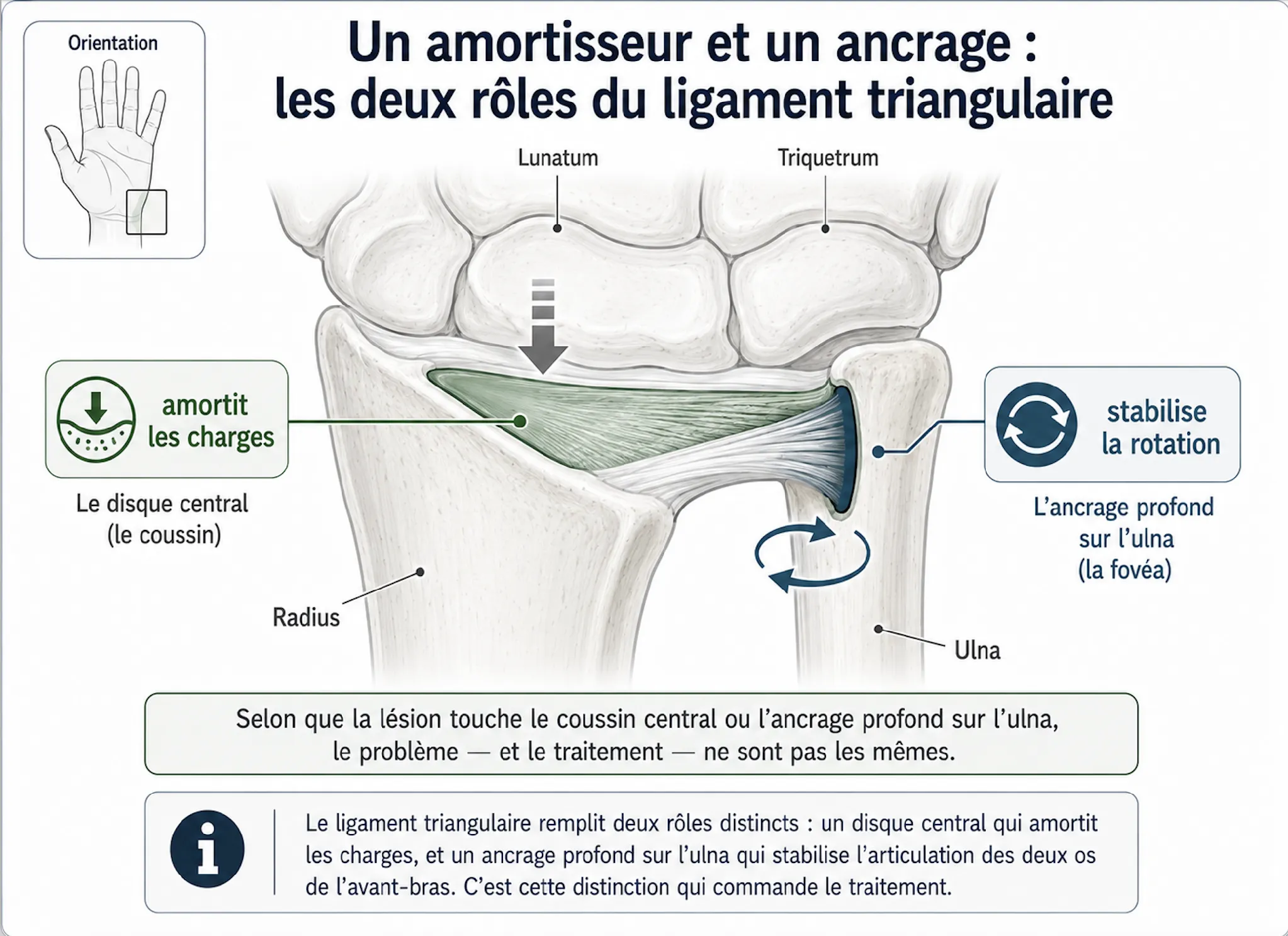 Lésion du ligament triangulaire — illustration médicale