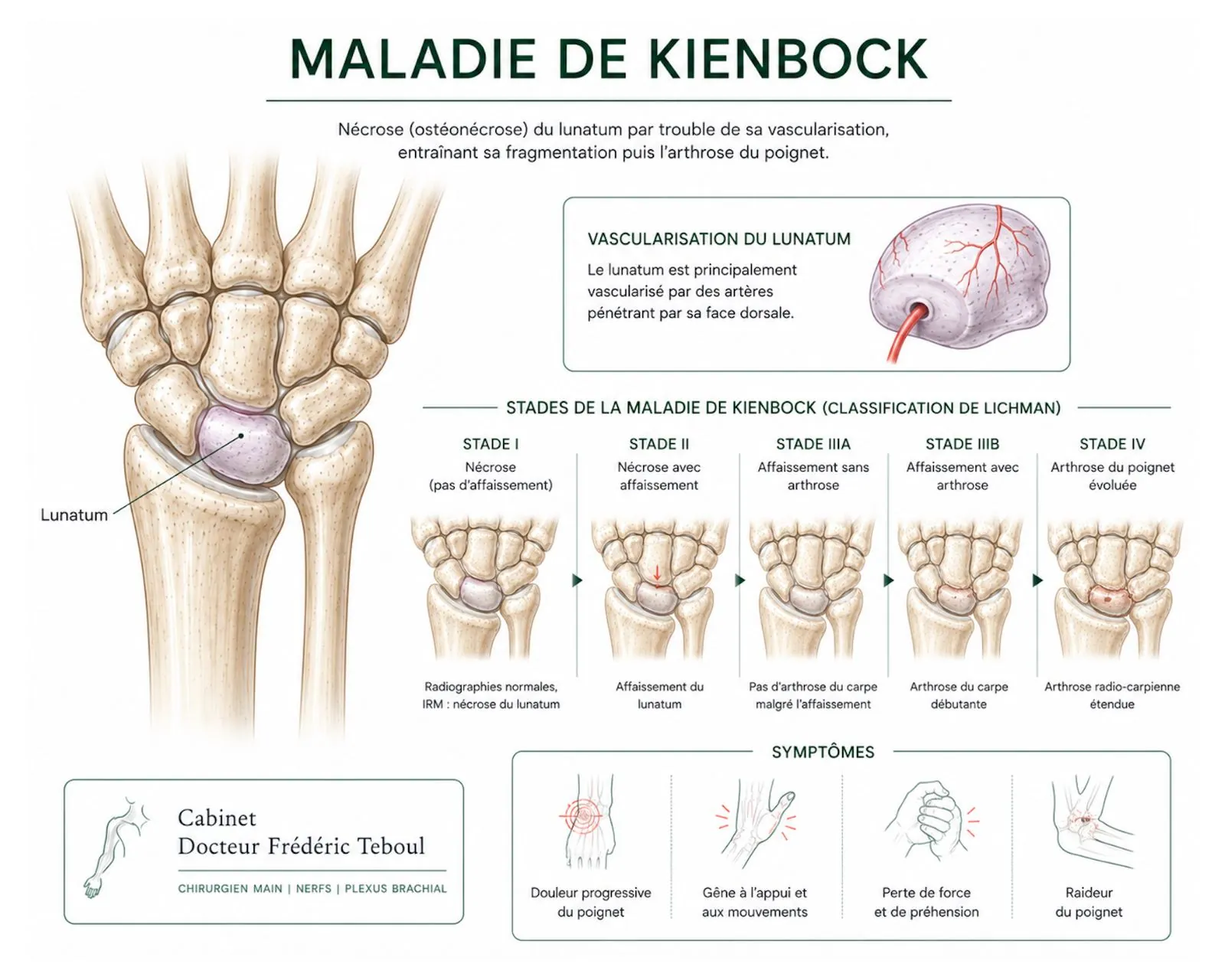 Maladie de Kienböck : nécrose du lunatum, vascularisation et stades de Lichtman — Dr Frédéric Teboul, chirurgien spécialiste de la main à Paris